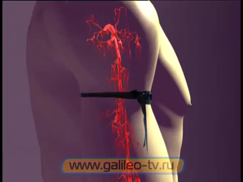 Галилео. Первая помощь (часть 3)
