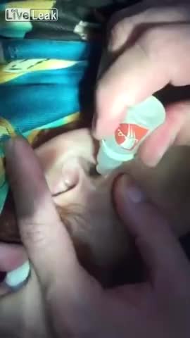 Как закапать ухо